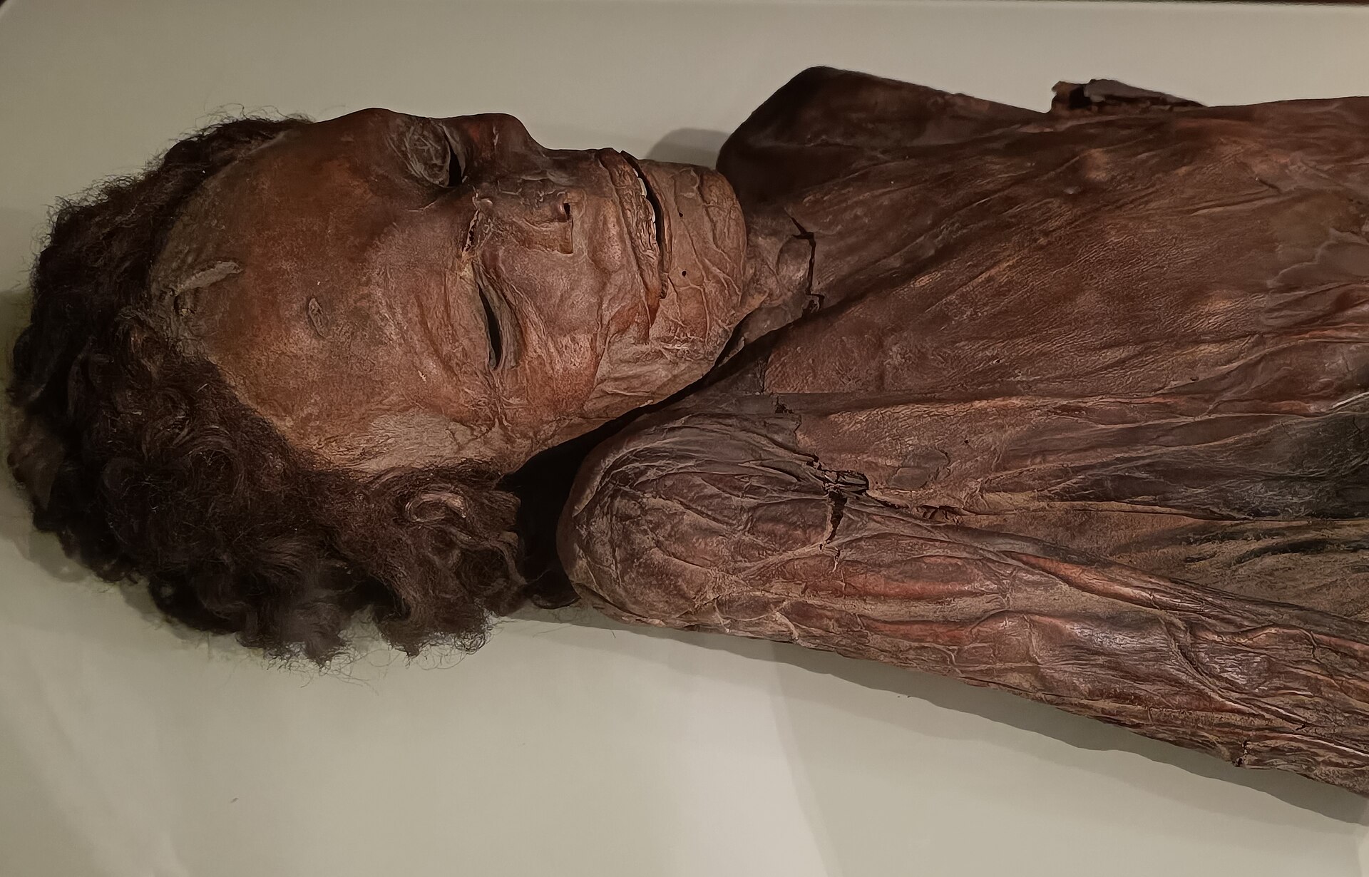 A Guanche mummy from Tenerife, showing the pre-conquest Canary Islanders' mummification, National Archaeological Museum, Madrid.